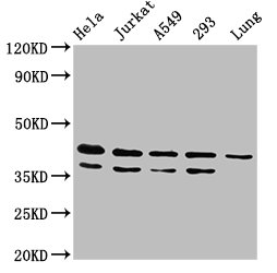 MAPK1 / ERK2 Antibody - Western Blot Positive WB detected in:Hela whole cell lysate, Jurkat whole cell lysate, A549 whole cell lysate,293 whole cell lysate,Rat lung tissue All Lanes:MAPK1 antibody at 4.8µg/ml Secondary Goat polyclonal to rabbit IgG at 1/50000 dilution Predicted band size: 42,37 KDa Observed band size: 42,37 KDa