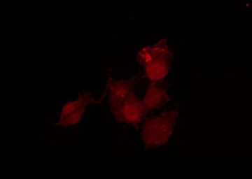 MAPK1 / ERK2 Antibody - Staining HeLa cells by IF/ICC. The samples were fixed with PFA and permeabilized in 0.1% Triton X-100, then blocked in 10% serum for 45 min at 25°C. The primary antibody was diluted at 1:200 and incubated with the sample for 1 hour at 37°C. An Alexa Fluor 594 conjugated goat anti-rabbit IgG (H+L) Ab, diluted at 1/600, was used as the secondary antibody.