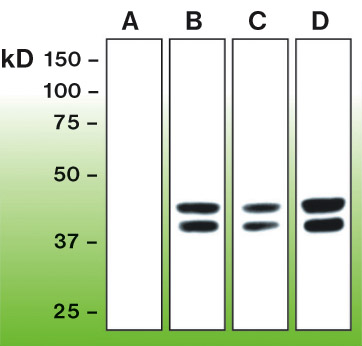 MAPK1 / ERK2 Antibody - Western blot of Erk 1,2 activation in untreated PC12 cells (A); cells treated with EGF-100 ng/ml, 5 min (B); PMA-100 nM, 30 min (C); in serum free DMEM, and EGF-100 ng/ml, 5min with 10% FBS in DMEM (D). Wells were equally loaded with 50 ug of who