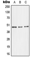 MAPK10 / JNK3 Antibody - Western blot analysis of JNK3 expression in NIH3T3 (A); SKNSH (B); HeLa (C) whole cell lysates.