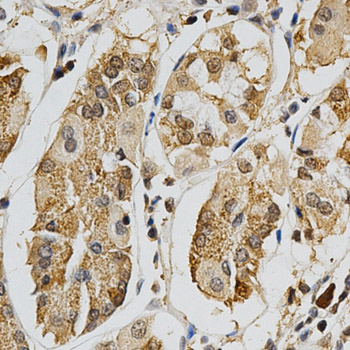 MAPK10 / JNK3 Antibody - Immunohistochemistry of paraffin-embedded human stomach tissue.