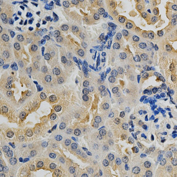MAPK10 / JNK3 Antibody - Immunohistochemistry of paraffin-embedded mouse kidney tissue.