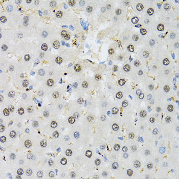 MAPK10 / JNK3 Antibody - Immunohistochemistry of paraffin-embedded rat liver tissue.