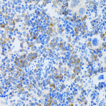 MAPK10 / JNK3 Antibody - Immunohistochemistry of paraffin-embedded mouse spleen tissue.