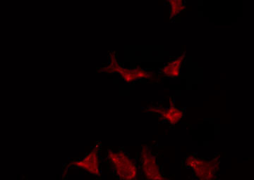 MAPK10 / JNK3 Antibody - Staining HeLa cells by IF/ICC. The samples were fixed with PFA and permeabilized in 0.1% Triton X-100, then blocked in 10% serum for 45 min at 25°C. The primary antibody was diluted at 1:200 and incubated with the sample for 1 hour at 37°C. An Alexa Fluor 594 conjugated goat anti-rabbit IgG (H+L) Ab, diluted at 1/600, was used as the secondary antibody.