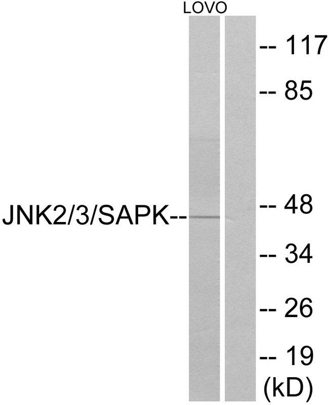 MAPK10 / JNK3 Antibody - Western blot analysis of extracts from LOVO cells, using SAPK/JNK (Ab-183) antibody.