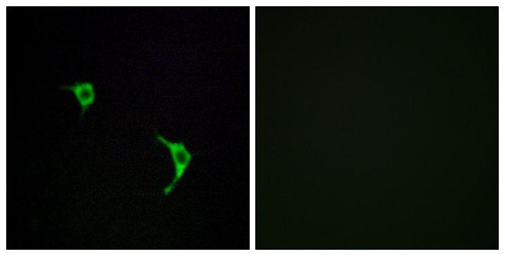 MAPK10 / JNK3 Antibody - Peptide - + Immunofluorescence analysis of LOVO cells, using SAPK/JNK (Ab-183) antibody.