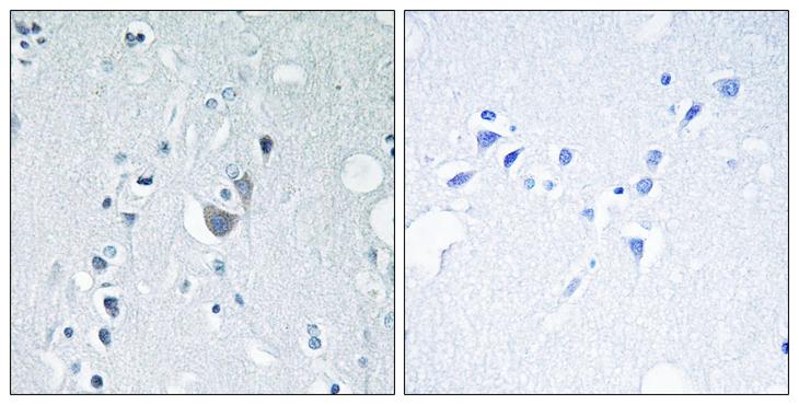 MAPK10 / JNK3 Antibody - P-peptide - + Immunohistochemistry analysis of paraffin-embedded human brain tissue using SAPK/JNK (Phospho-Tyr185) antibody.