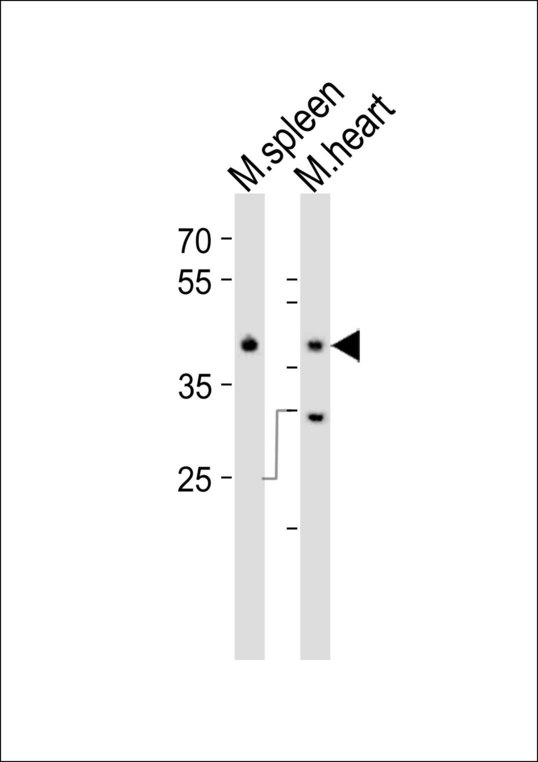 MAPK11 / SAPK2 / p38 Beta Antibody - Western blot of lysates from mouse spleen, mouse heart tissue lysate (from left to right), using Mapk11 Antibody. Antibody was diluted at 1:1000 at each lane. A goat anti-rabbit IgG H&L (HRP) at 1:10000 dilution was used as the secondary antibody. Lysates at 20ug per lane.