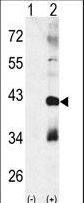 MAPK11 / SAPK2 / p38 Beta Antibody - Western blot of CTDSP1 (arrow) using rabbit polyclonal p38 beta Antibody. 293 cell lysates (2 ug/lane) either nontransfected (Lane 1) or transiently transfected with the CTDSP1 gene (Lane 2) (Origene Technologies).