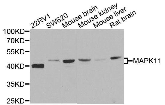 MAPK11 / SAPK2 / p38 Beta Antibody - Western blot analysis of extracts of various cells.