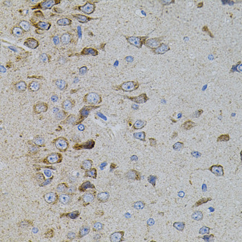 MAPK11 / SAPK2 / p38 Beta Antibody - Immunohistochemistry of paraffin-embedded rat brain tissue.