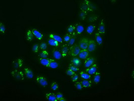 MAPK11 / SAPK2 / p38 Beta Antibody - Immunofluorescent staining of HT29 cells using anti-MAPK11 mouse monoclonal antibody.