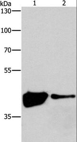 MAPK11 / SAPK2 / p38 Beta Antibody - Western blot analysis of 293T and human fetal brain tissue, using MAPK11 Polyclonal Antibody at dilution of 1:200.