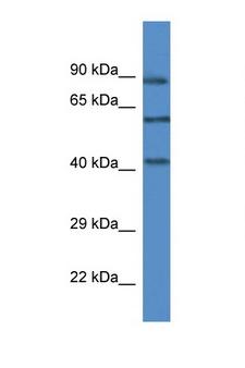 MAPK12 / ERK6 / SAPK3 Antibody - MAPK12 / ERK5 antibody Western blot of Mouse Liver lysate. Antibody concentration 1 ug/ml. This image was taken for the unconjugated form of this product. Other forms have not been tested.