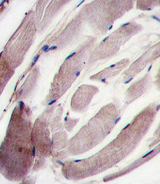 MAPK12 / ERK6 / SAPK3 Antibody - Formalin-fixed and paraffin-embedded human skeletal muscle tissue reacted with the P38 gamma antibody , which was peroxidase-conjugated to the secondary antibody, followed by DAB staining. This data demonstrates the use of this antibody for immunohistochemistry; clinical relevance has not been evaluated.