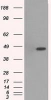 MAPK12 / ERK6 / SAPK3 Antibody - HEK293T cells were transfected with the pCMV6-ENTRY control (Left lane) or pCMV6-ENTRY MAPK12 (Right lane) cDNA for 48 hrs and lysed. Equivalent amounts of cell lysates (5 ug per lane) were separated by SDS-PAGE and immunoblotted with anti-MAPK12.
