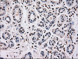 MAPK12 / ERK6 / SAPK3 Antibody - IHC of paraffin-embedded breast tissue using anti-MAPK12 mouse monoclonal antibody. (Dilution 1:50).