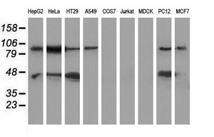MAPK12 / ERK6 / SAPK3 Antibody - Western blot of extracts (35 ug) from 9 different cell lines by using anti-MAPK7 monoclonal antibody.