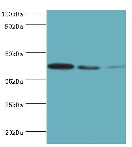 MAPK13 / p38delta Antibody - Western blot. All lanes: Mitogen-activated protein kinase 13 antibody at 3 ug/ml. Lane 1: HepG2 whole cell lysate. Lane 2: HeLa whole cell lysate. Lane 3: MCF-7 whole cell lysate. secondary Goat polyclonal to rabbit at 1:10000 dilution. Predicted band size: 42 kDa. Observed band size: 42 kDa.