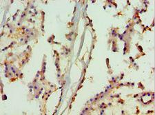 MAPK13 / p38delta Antibody - Immunohistochemistry of paraffin-embedded human prostate using antibody at 1:100 dilution.