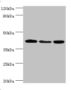MAPK13 / p38delta Antibody - Western blot All lanes: Mitogen-activated protein kinase 13 antibody at 3µg/ml Lane 1: HepG2 whole cell lysate Lane 2: Hela whole cell lysate Lane 3: MCF-7 whole cell lysate Secondary Goat polyclonal to rabbit IgG at 1/10000 dilution Predicted band size: 43, 29 kDa Observed band size: 43 kDa