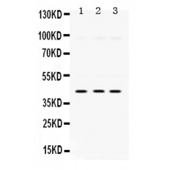 MAPK13 / p38delta Antibody - SAPK4 antibody Western blot. All lanes: Anti SAPK4 at 0.5 ug/ml. Lane 1: Rat Kidney Tissue Lysate at 50 ug. Lane 2: HELA Whole Cell Lysate at 40 ug. Lane 3: A549 Whole Cell Lysate at 40 ug. Predicted band size: 42 kD. Observed band size: 42 kD.