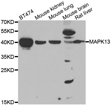 MAPK13 / p38delta Antibody - Western blot analysis of extracts of various cell lines.