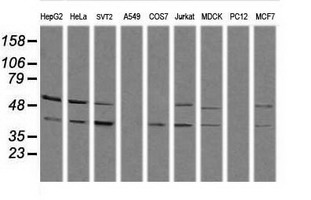 MAPK13 / p38delta Antibody - Western blot of extracts (35 ug) from 9 different cell lines by using g anti-MAPK13 monoclonal antibody (HepG2: human; HeLa: human; SVT2: mouse; A549: human; COS7: monkey; Jurkat: human; MDCK: canine; PC12: rat; MCF7: human).