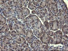MAPK13 / p38delta Antibody - IHC of paraffin-embedded Human pancreas tissue using anti-MAPK13 mouse monoclonal antibody.