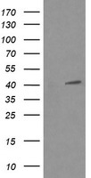 MAPK13 / p38delta Antibody - HEK293T cells were transfected with the pCMV6-ENTRY control (Left lane) or pCMV6-ENTRY MAPK13 (Right lane) cDNA for 48 hrs and lysed. Equivalent amounts of cell lysates (5 ug per lane) were separated by SDS-PAGE and immunoblotted with anti-MAPK13.