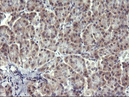 MAPK13 / p38delta Antibody - IHC of paraffin-embedded Human pancreas tissue using anti-MAPK13 mouse monoclonal antibody. (Heat-induced epitope retrieval by 10mM citric buffer, pH6.0, 120°C for 3min).