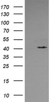 MAPK13 / p38delta Antibody - HEK293T cells were transfected with the pCMV6-ENTRY control (Left lane) or pCMV6-ENTRY MAPK13 (Right lane) cDNA for 48 hrs and lysed. Equivalent amounts of cell lysates (5 ug per lane) were separated by SDS-PAGE and immunoblotted with anti-MAPK13.