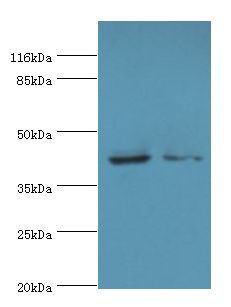 MAPK13 / p38delta Antibody - Western blot. All lanes: MAPK13 antibody at 2 ug/ml. Lane 1: HeLa cells. Lane 2: A549 cells. Secondary Goat polyclonal to rabbit at 1:10000 dilution. Predicted band size: 42 kDa. Observed band size: 42 kDa.