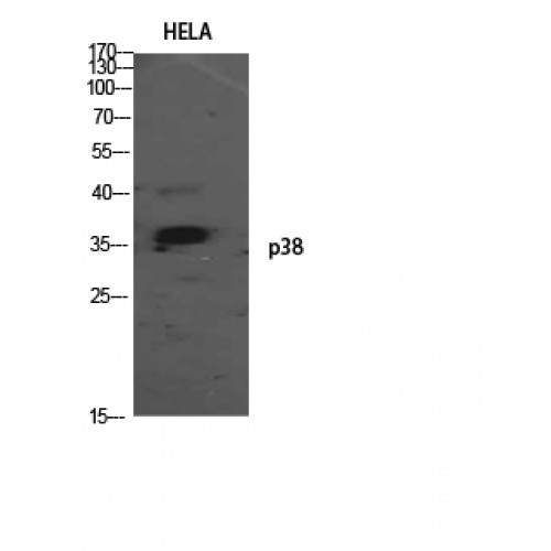 MAPK14 / p38 Antibody - Western blot of p38 antibody