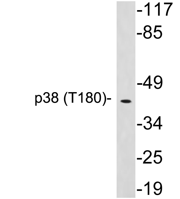 MAPK14 / p38 Antibody - Western blot analysis of lysates from HepG2 cells, using p38 antibody.