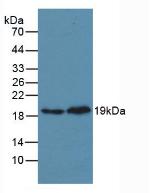 MAPK14 / p38 Antibody - Western Blot; Sample. Lane1: Mouse Heart Tissue; Lane2: Rat Heart Tissue.