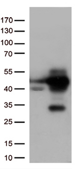 MAPK14 / p38 Antibody - HEK293T cells were transfected with the pCMV6-ENTRY control. (Left lane) or pCMV6-ENTRY MAPK14. (Right lane) cDNA for 48 hrs and lysed. Equivalent amounts of cell lysates. (5 ug per lane) were separated by SDS-PAGE and immunoblotted with anti-MAPK14. (1:500)