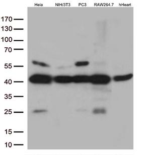 MAPK14 / p38 Antibody - Western blot analysis of extracts. (35ug) from 4 different cell lines and human Heart tissue lysates by using anti-MAPK14 monoclonal antibody. (1:500)