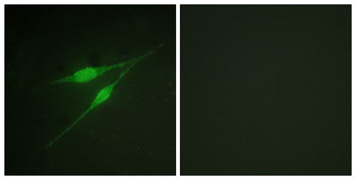 MAPK14 / p38 Antibody - Immunofluorescence analysis of NIH/3T3 cells, using p38 MAPK Antibody. The picture on the right is blocked with the synthesized peptide.