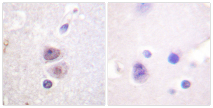 MAPK14 / p38 Antibody - Immunohistochemistry analysis of paraffin-embedded human brain tissue, using p38 MAPK Antibody. The picture on the right is blocked with the synthesized peptide.