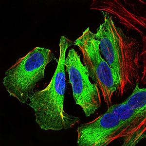 MAPK14 / p38 Antibody - Immunofluorescence of HeLa cells using MAPK14 mouse monoclonal antibody (green). Blue: DRAQ5 fluorescent DNA dye. Red: Actin filaments have been labeled with Alexa Fluor-555 phalloidin.