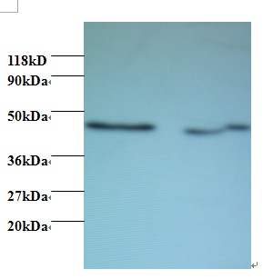 MAPK14 / p38 Antibody - Western blot of Activator of 90 kDa heat shock protein ATPase homolog 1 antibody at 2 ug/ml. Lane 1: EC109 whole cell lysate. Lane 2: 293T whole cell lysate. Secondary: Goat polyclonal to Rabbit IgG at 1:15000 dilution. Predicted band size: 37 kDa. Observed band size: 45 kDa.  This image was taken for the unconjugated form of this product. Other forms have not been tested.