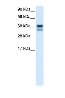 MAPK14 / p38 Antibody - MAPK14 / p38 antibody Western blot of Placenta Tissue lysate. Antibody concentration 1 ug/ml. This image was taken for the unconjugated form of this product. Other forms have not been tested.