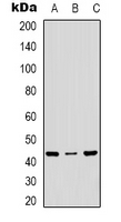 MAPK14 / p38 Antibody - Western blot analysis of p38 expression in Jurkat (A); HepG2 (B); K562 (C) whole cell lysates.