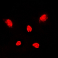 MAPK14 / p38 Antibody - Immunofluorescent analysis of p38 staining in Jurkat cells. Formalin-fixed cells were permeabilized with 0.1% Triton X-100 in TBS for 5-10 minutes and blocked with 3% BSA-PBS for 30 minutes at room temperature. Cells were probed with the primary antibody in 3% BSA-PBS and incubated overnight at 4 deg C in a humidified chamber. Cells were washed with PBST and incubated with a DyLight 594-conjugated secondary antibody (red) in PBS at room temperature in the dark. DAPI was used to stain the cell nuclei (blue).