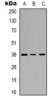 MAPK14 / p38 Antibody - Western blot analysis of p38 expression in HeLa (A); HepG2 (B); PC3 (C) whole cell lysates.