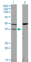 MAPK14 / p38 Antibody - Western blot of MAPK14 expression in transfected 293T cell line by MAPK14 monoclonal antibody (M01), clone 3D5.