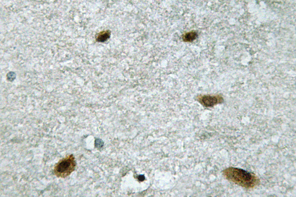 MAPK14 / p38 Antibody - IHC of p38 (H174) pAb in paraffin-embedded human brain tissue.