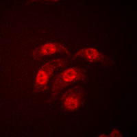 MAPK14 / p38 Antibody - Immunofluorescent analysis of p38 staining in HeLa cells. Formalin-fixed cells were permeabilized with 0.1% Triton X-100 in TBS for 5-10 minutes and blocked with 3% BSA-PBS for 30 minutes at room temperature. Cells were probed with the primary antibody in 3% BSA-PBS and incubated overnight at 4 C in a humidified chamber. Cells were washed with PBST and incubated with a DyLight 594-conjugated secondary antibody (red) in PBS at room temperature in the dark. DAPI was used to stain the cell nuclei (blue).